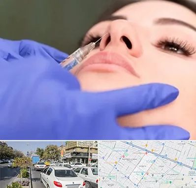 هیالاز در مفتح مشهد