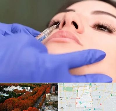 هیالاز در منطقه 6 تهران 