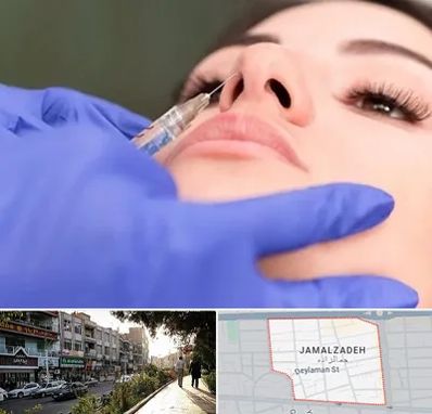 هیالاز در خیابان جمالزاده
