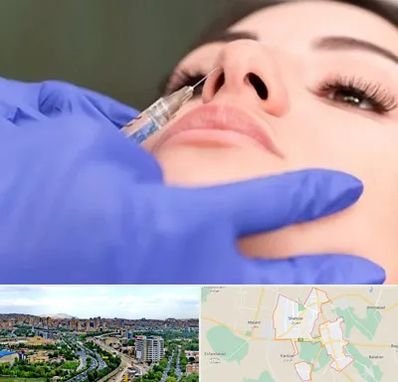 هیالاز در شهریار