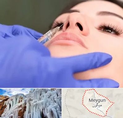 هیالاز در میگون