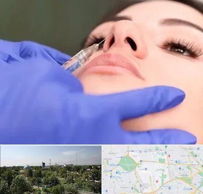 هیالاز در منطقه 16 تهران 