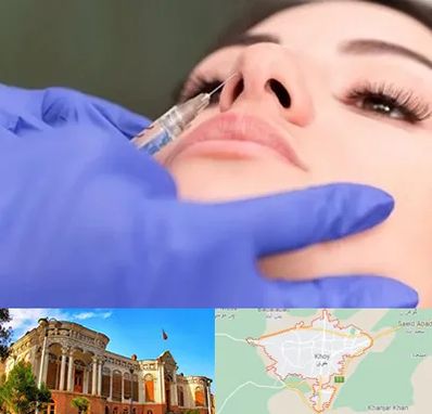 هیالاز در خوی