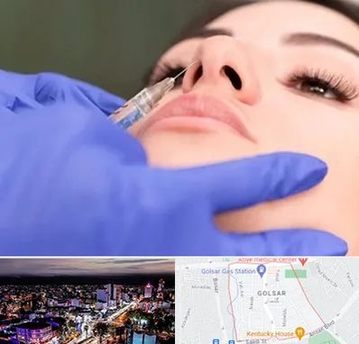 هیالاز در گلسار رشت 