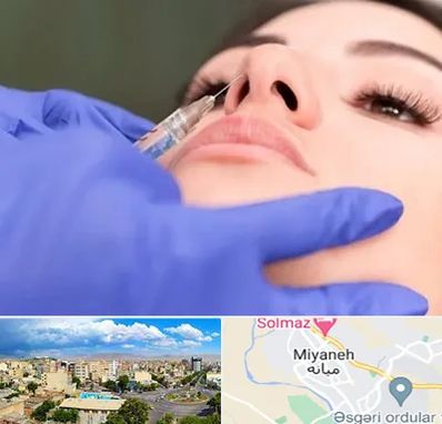 هیالاز در میانه