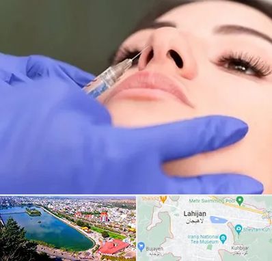 هیالاز در لاهیجان