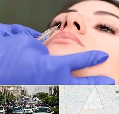 هیالاز در سیدی مشهد