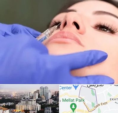 هیالاز در الهیه 