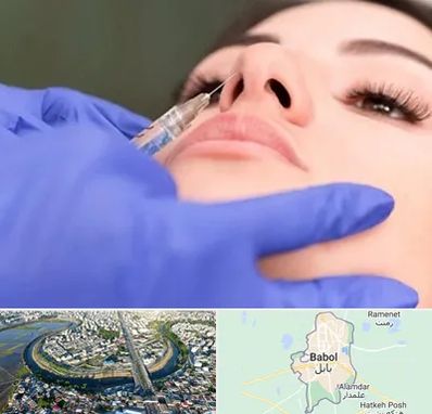 هیالاز در بابل