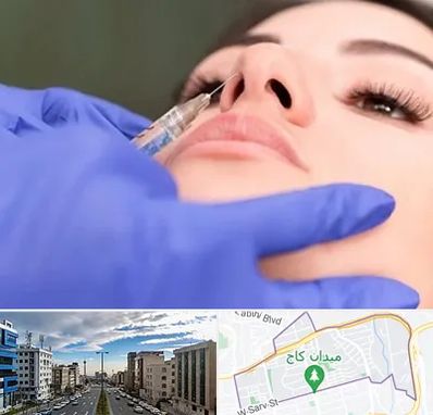 هیالاز در سعادت آباد 