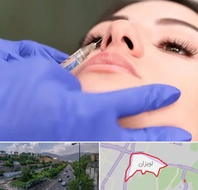 هیالاز در لویزان