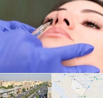 هیالاز در کیانمهر کرج