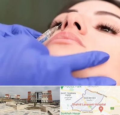 هیالاز در حکیمیه 