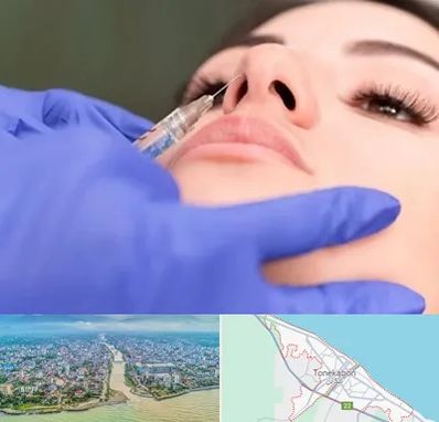 هیالاز در تنکابن