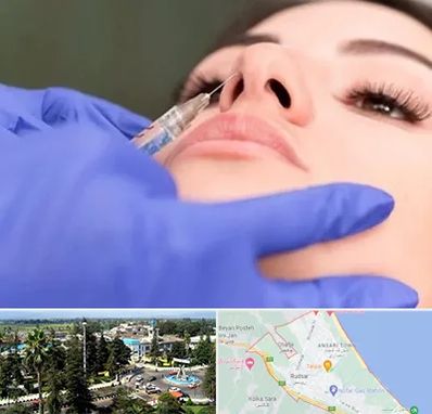 هیالاز در رودسر