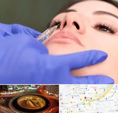 هیالاز در میدان ولیعصر 