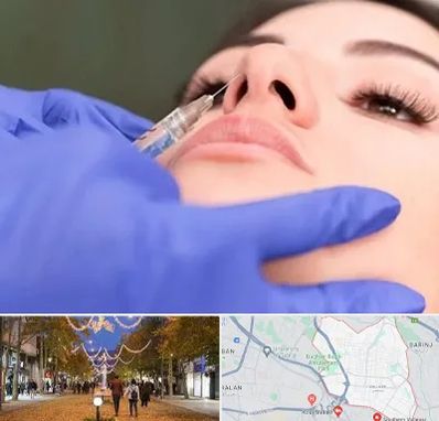 هیالاز در ولیعصر ارومیه