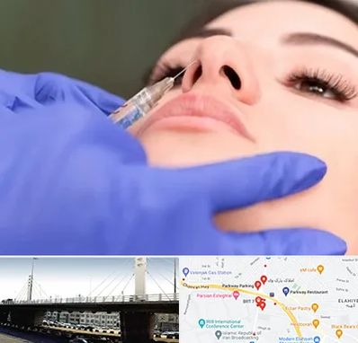 هیالاز در پارک وی 