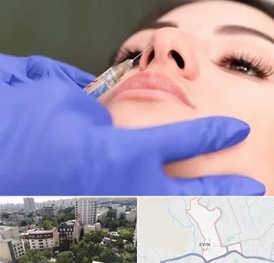 هیالاز در اوین