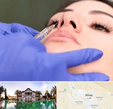 هیالاز در شیراز