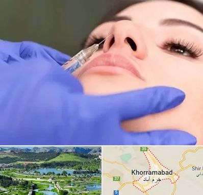 هیالاز در خرم آباد