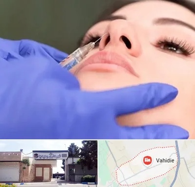 هیالاز در وحیدیه شهریار