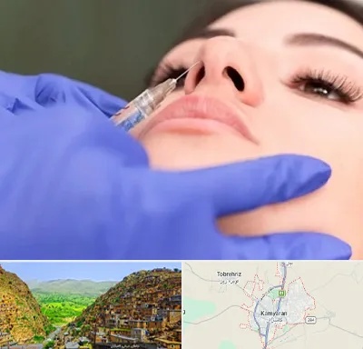 هیالاز در کامیاران