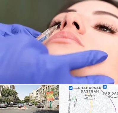 هیالاز در چهارصد دستگاه 