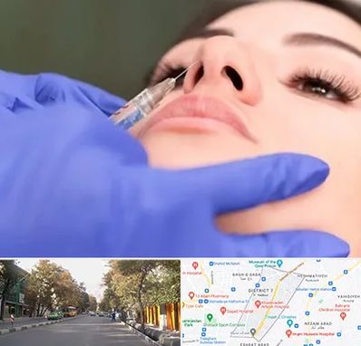 هیالاز در شریعتی 