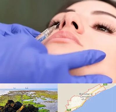 هیالاز در بندرلنگه