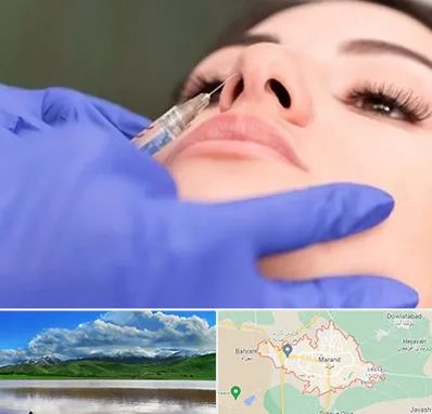 هیالاز در مرند