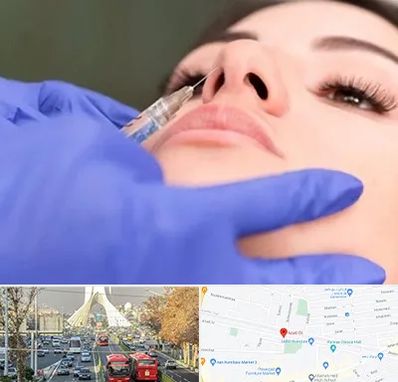 هیالاز در خیابان آزادی 