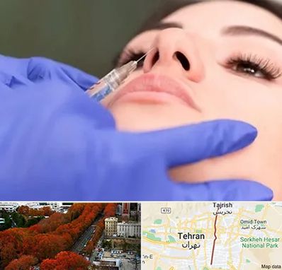 هیالاز در ولیعصر 