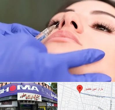 هیالاز در امین حضور