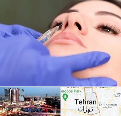 هیالاز در صادقیه 