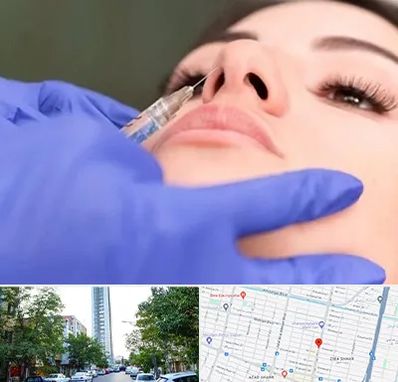 هیالاز در امامت مشهد