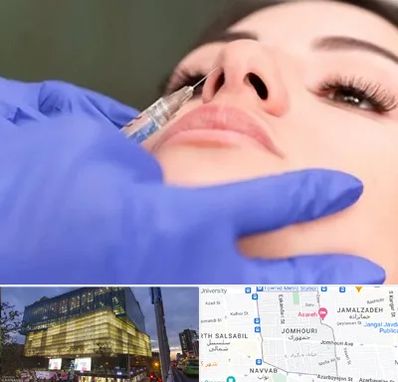 هیالاز در جمهوری 