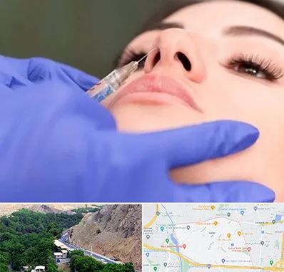 هیالاز در کن 