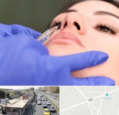 هیالاز در خیابان دماوند