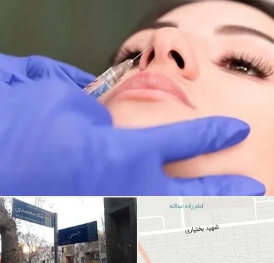 هیالاز در سی متری جی