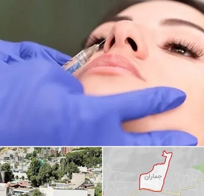 هیالاز در جماران