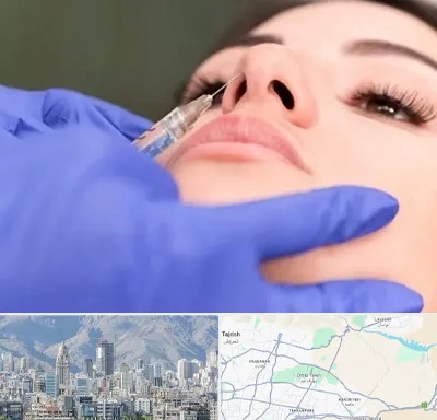 هیالاز در شمال شرق تهران