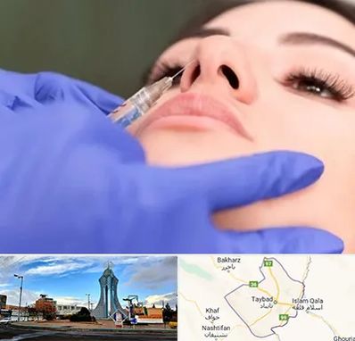 هیالاز در تایباد