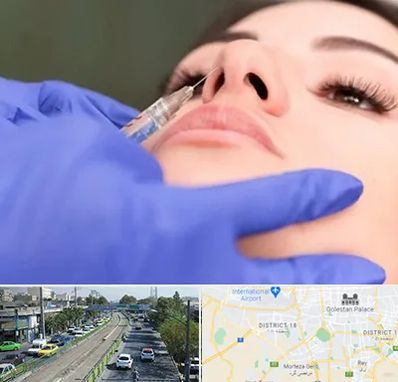 هیالاز در جنوب تهران 