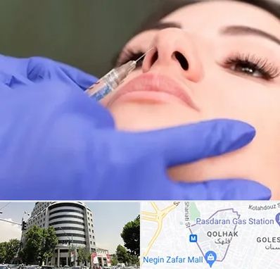 هیالاز در قلهک 