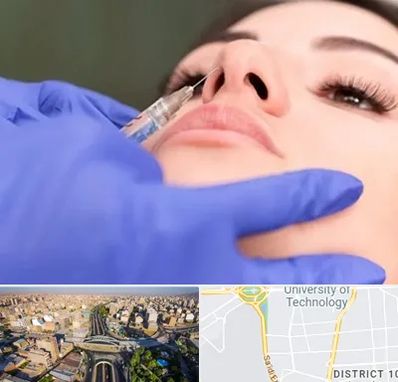 هیالاز در استاد معین 