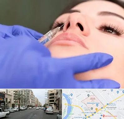 هیالاز در زیتون کارمندی اهواز