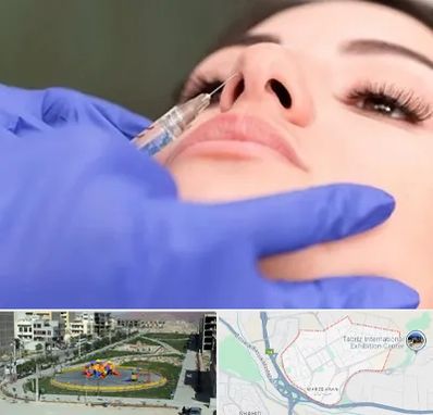 هیالاز در مرزداران تبریز