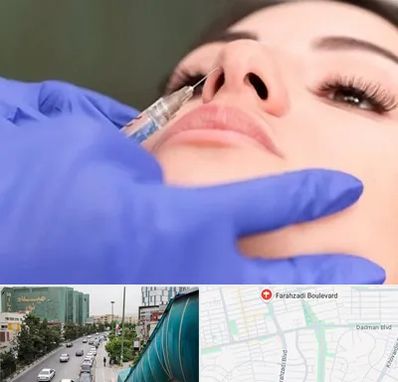 هیالاز در بلوار فرحزادی