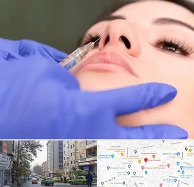 هیالاز در فاطمی 